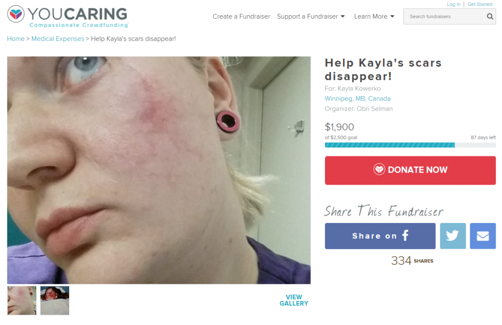 Screenshot of the YouCaring fundraising campaign for Kayla.